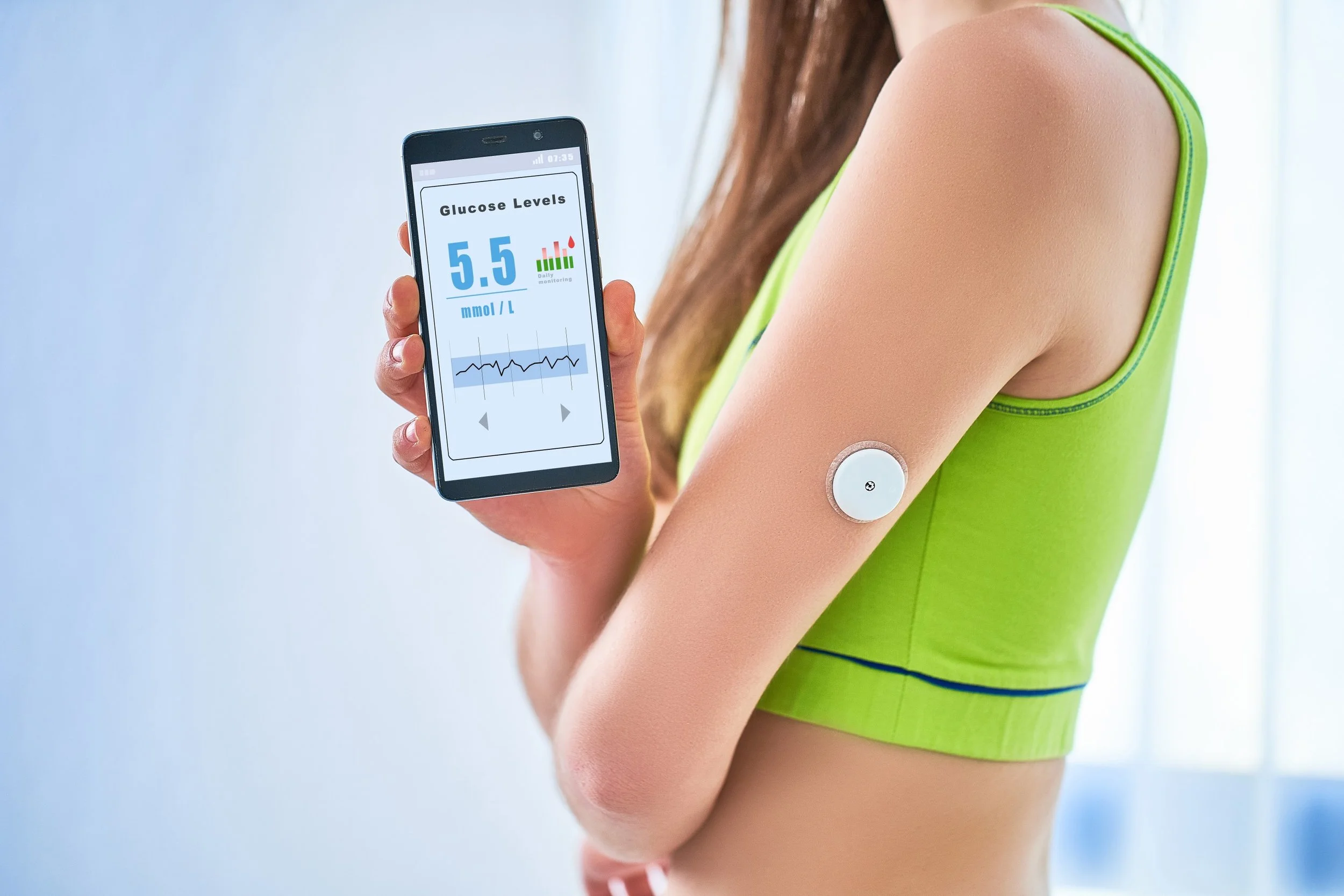 Data chart showing CGM readings