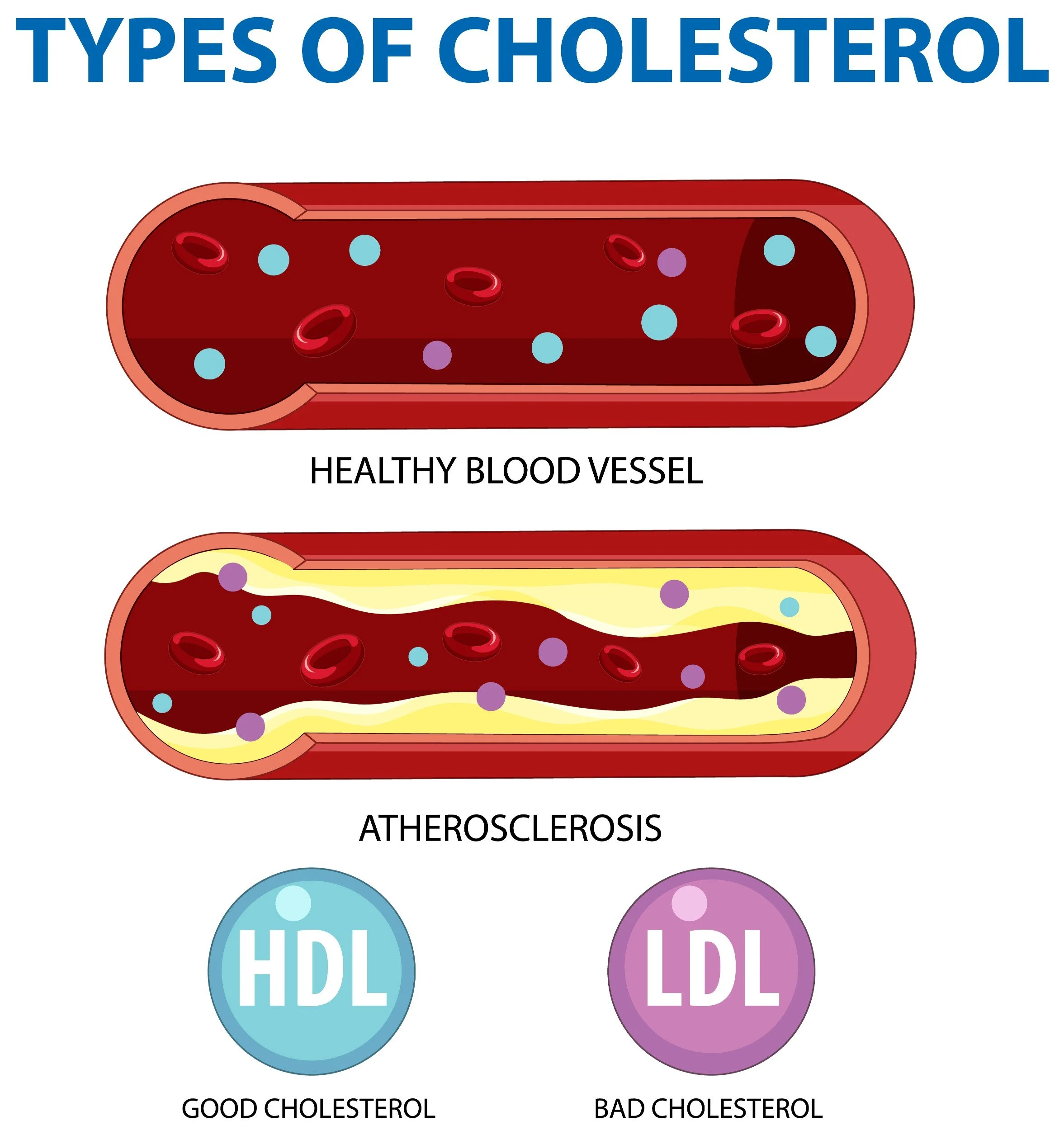 Types of cholesterol